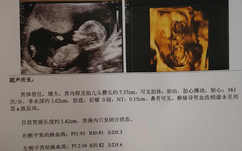 供卵试管代怀包双胞胎-双胞胎梦想实现供卵试管代怀包双胞胎助你圆梦