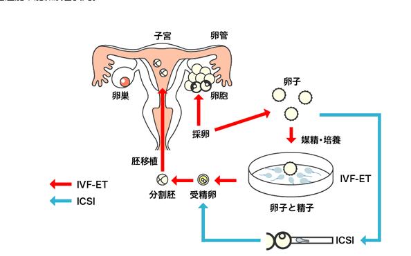 供卵移植成功率_供卵移植成功率：如何提高成功率？
